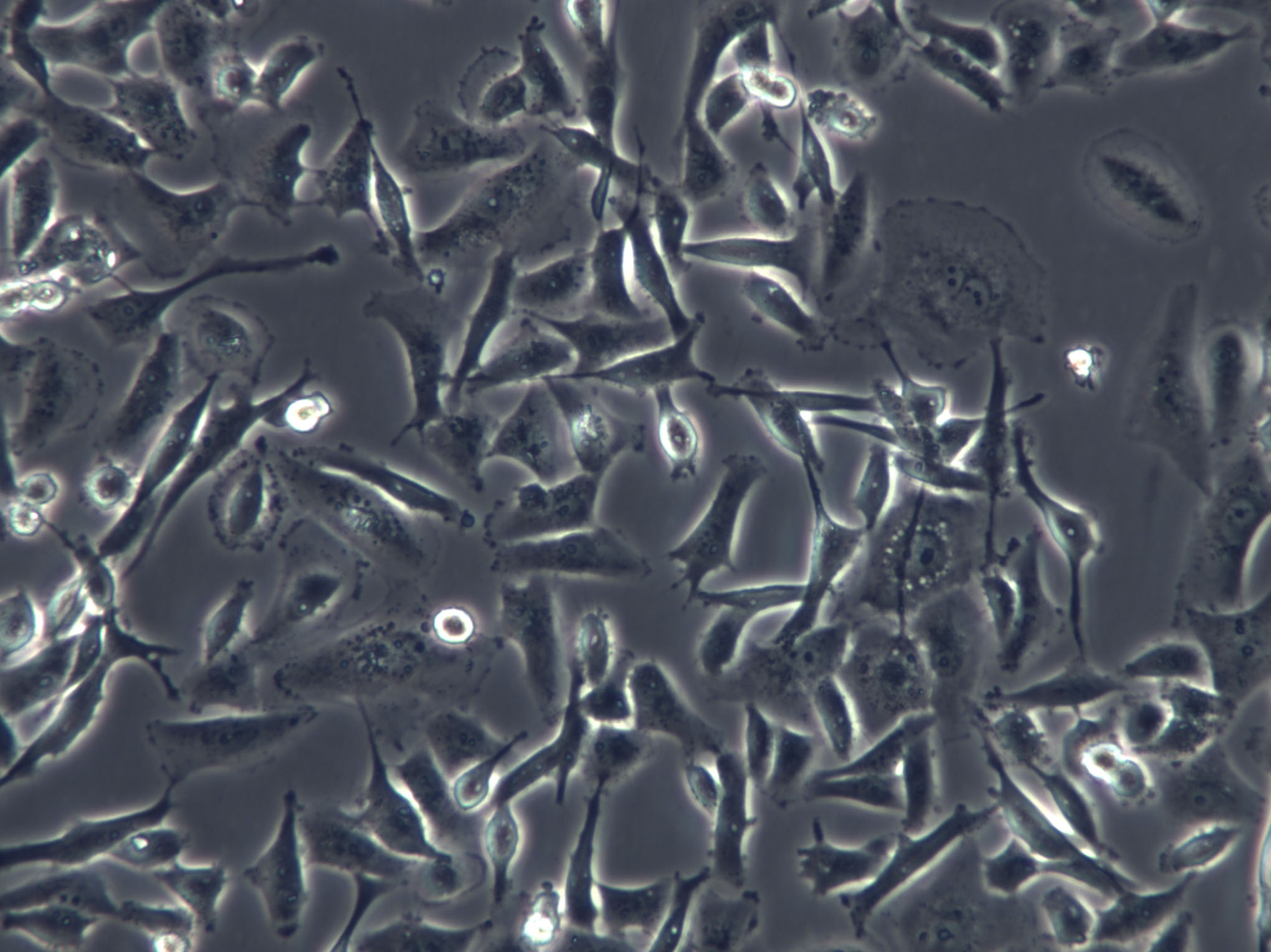 NOZ Cell|人胆囊癌细胞