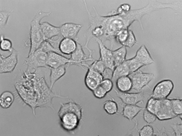 HS-5 Cell|人骨髓基质细胞