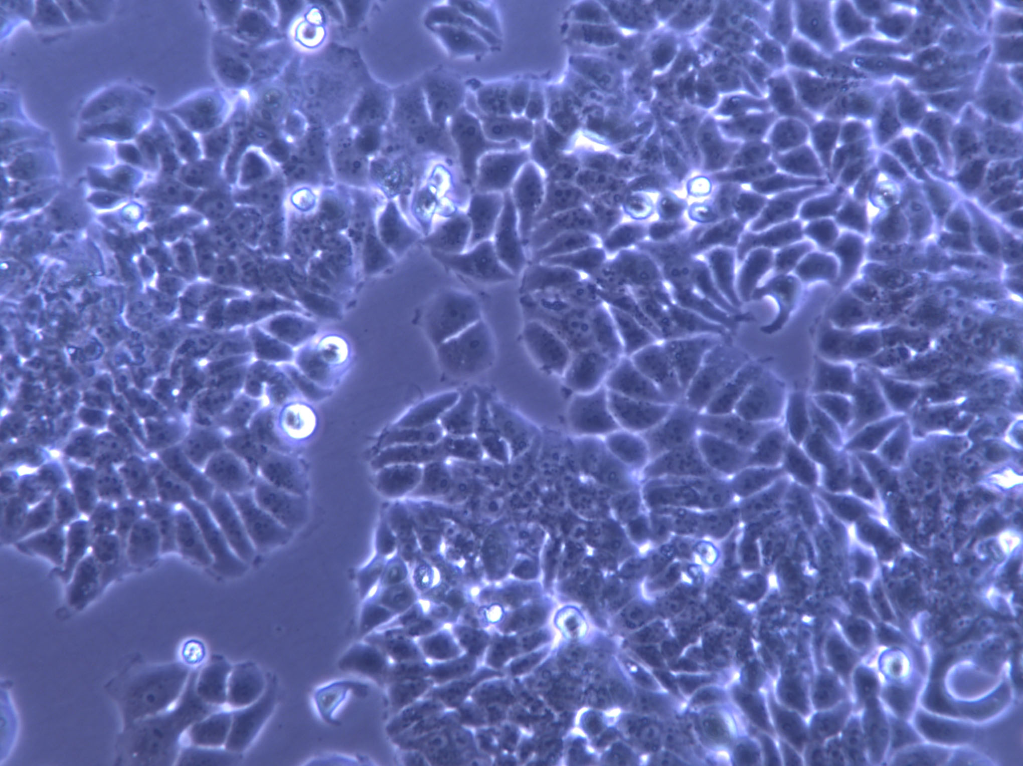 HEK293T/17 Cell|人胚肾细胞