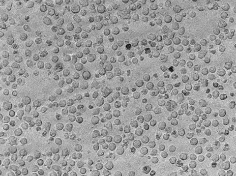 SU-DHL-1|人间变性大细胞淋巴瘤血清培养细胞(免费送STR)