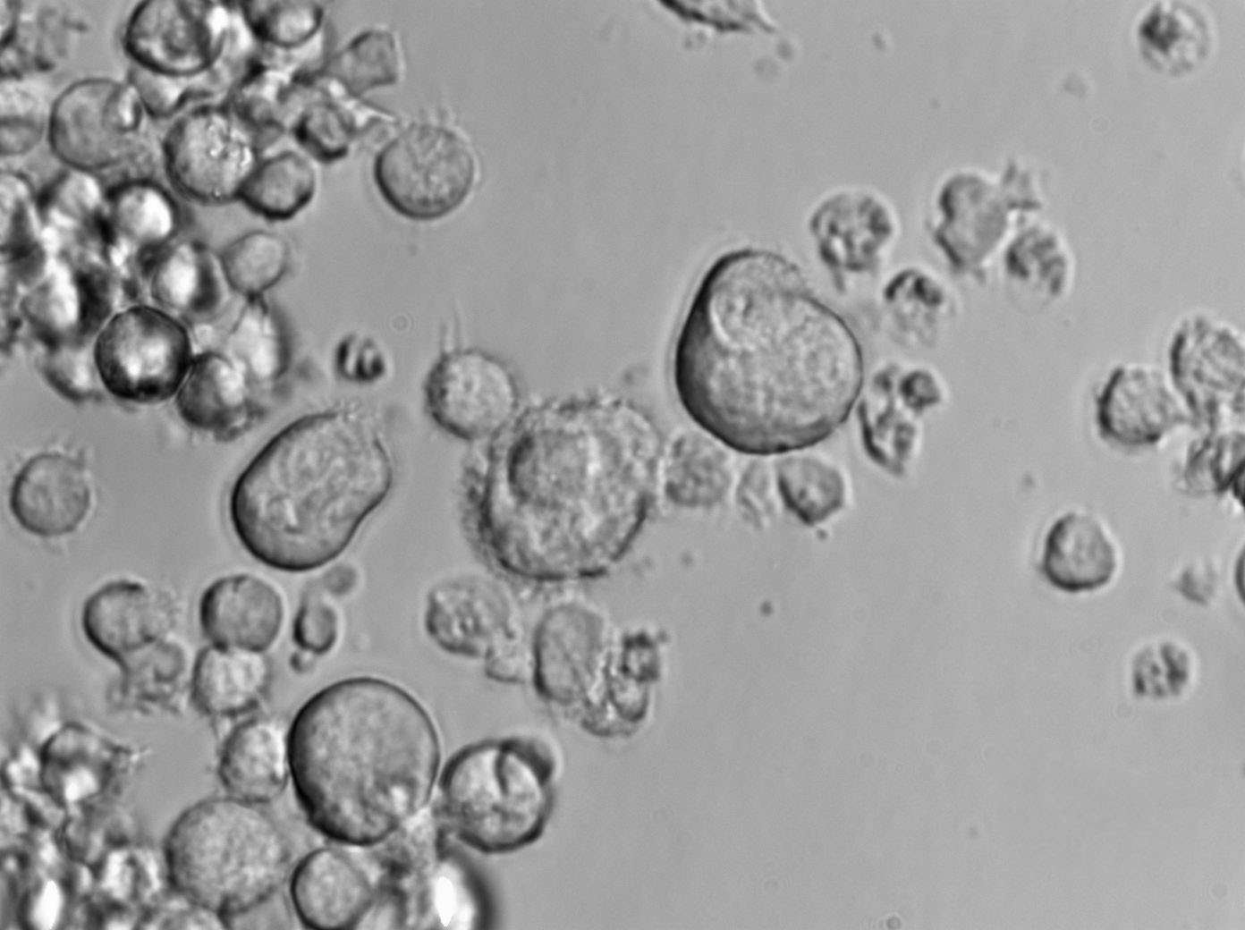 KM-H2|人霍奇金淋巴瘤血清培养细胞(免费送STR)KM-H2|人霍奇金淋巴瘤血清培养细胞(免费送STR)