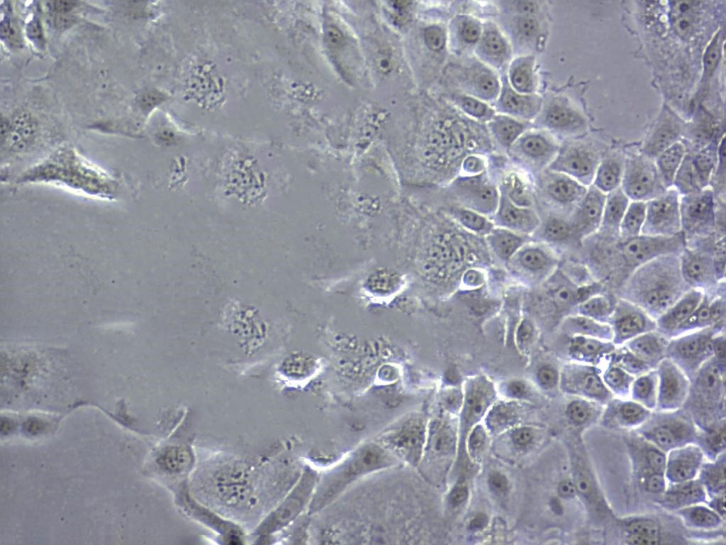 Tb 1 Lu Cell|蝙蝠肺细胞