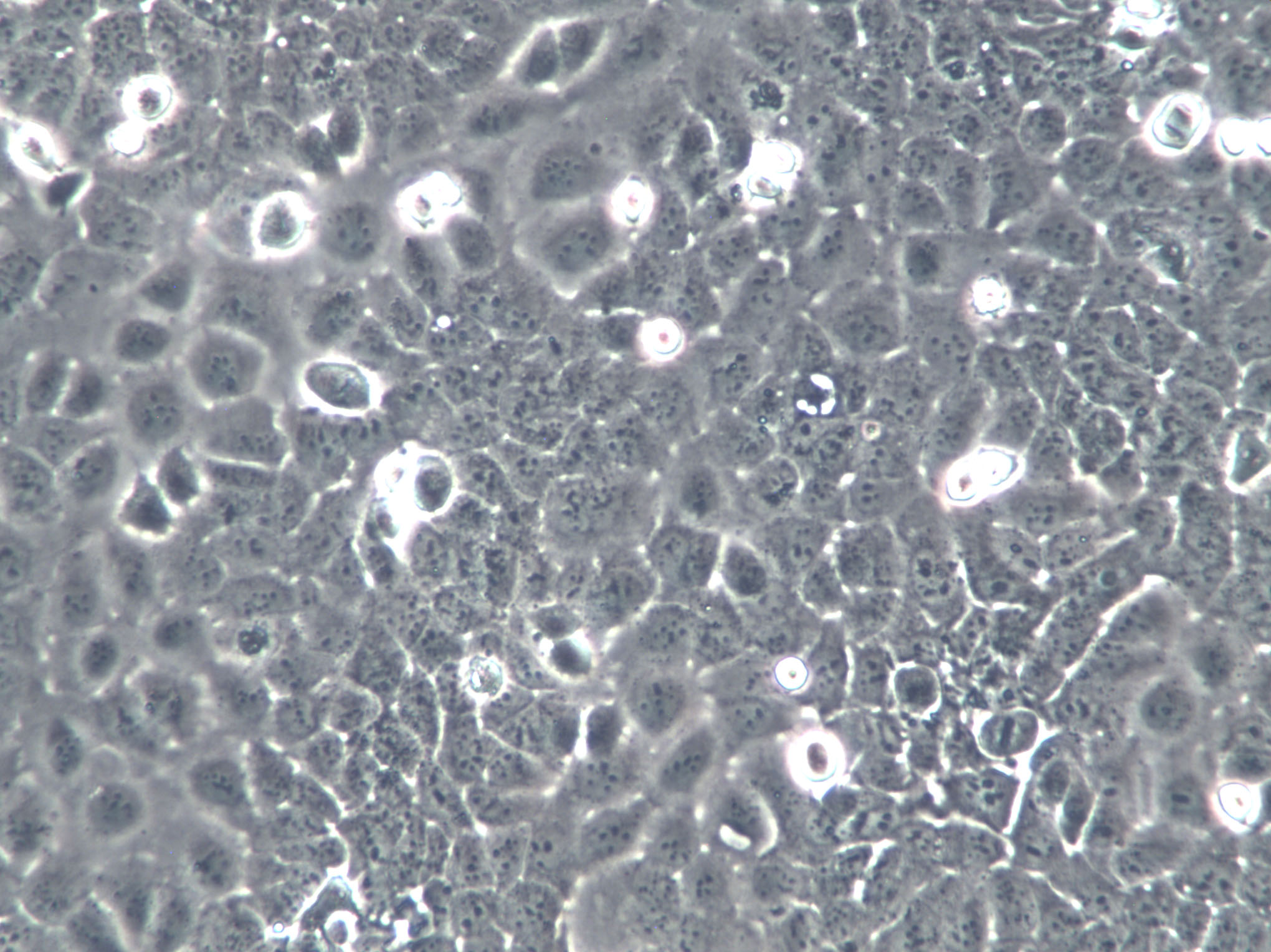 KM12-SM Cell|人结肠癌肝转移细胞