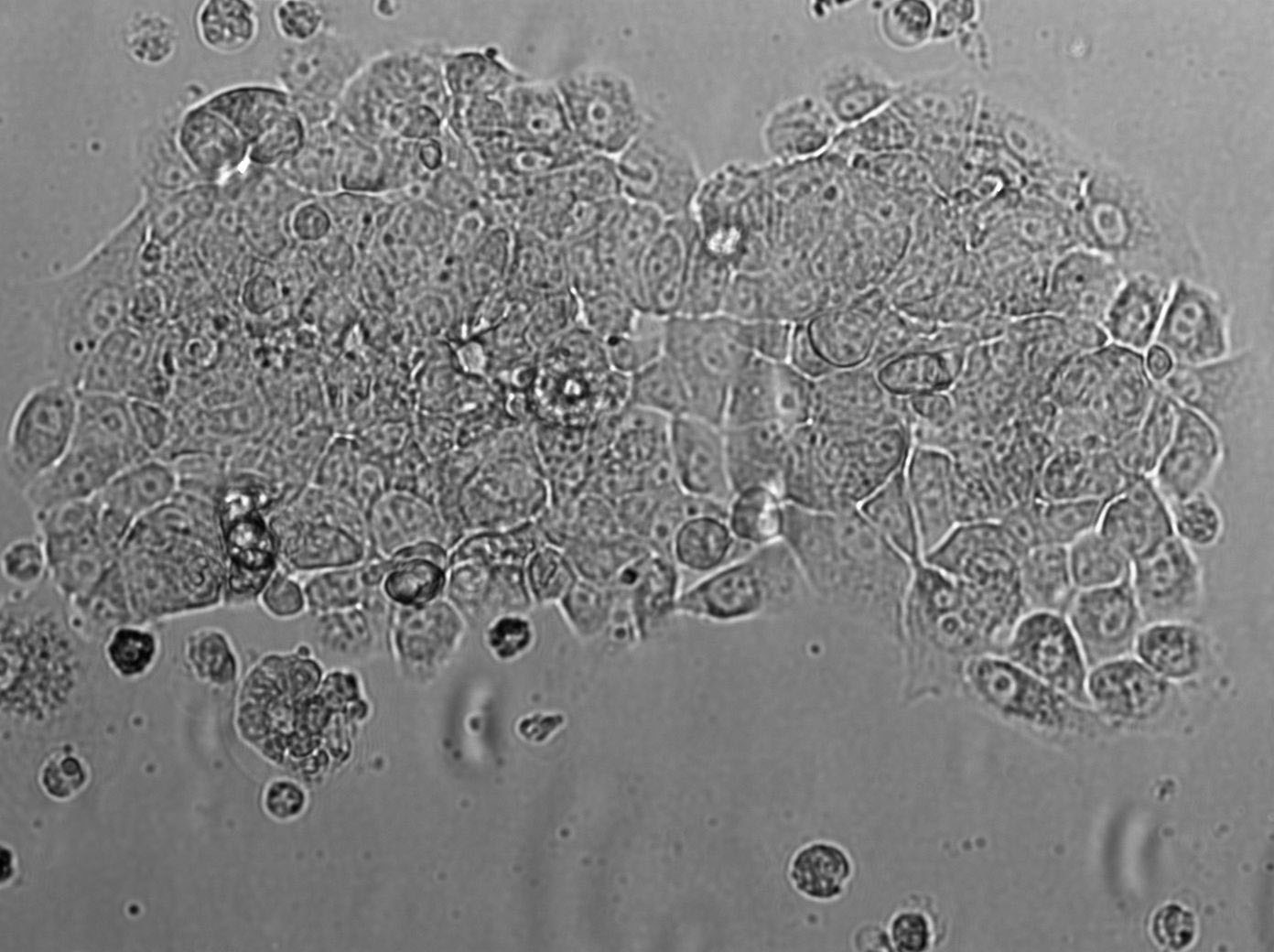 SMC-1 Cell|人胸膜间皮瘤细胞