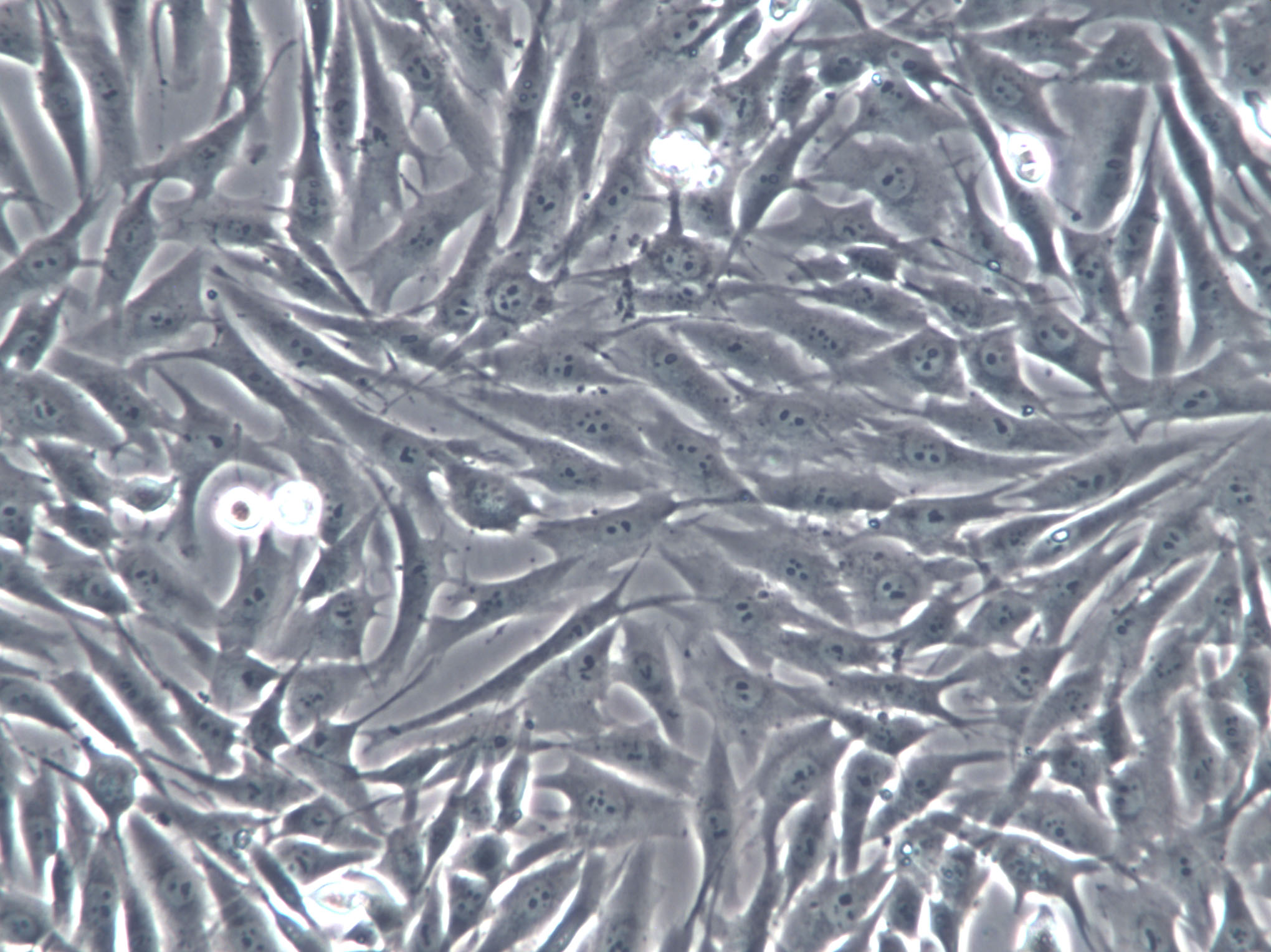 MEC-1 Cell|人粘液表皮样癌细胞