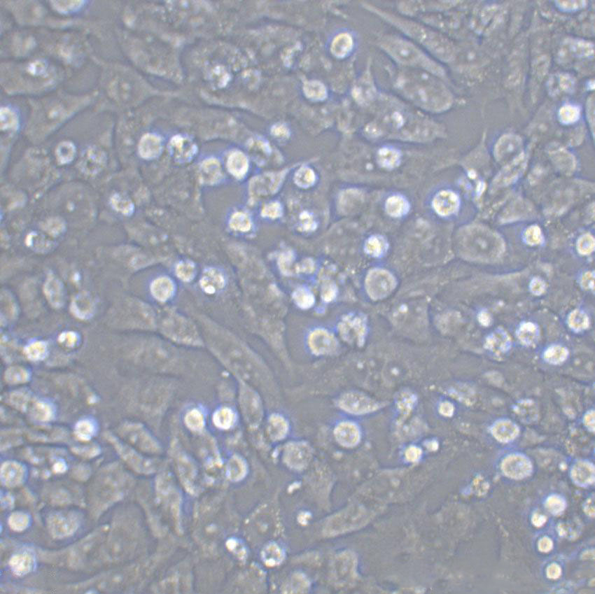 SSP-25 Cell|人肝胆管癌细胞