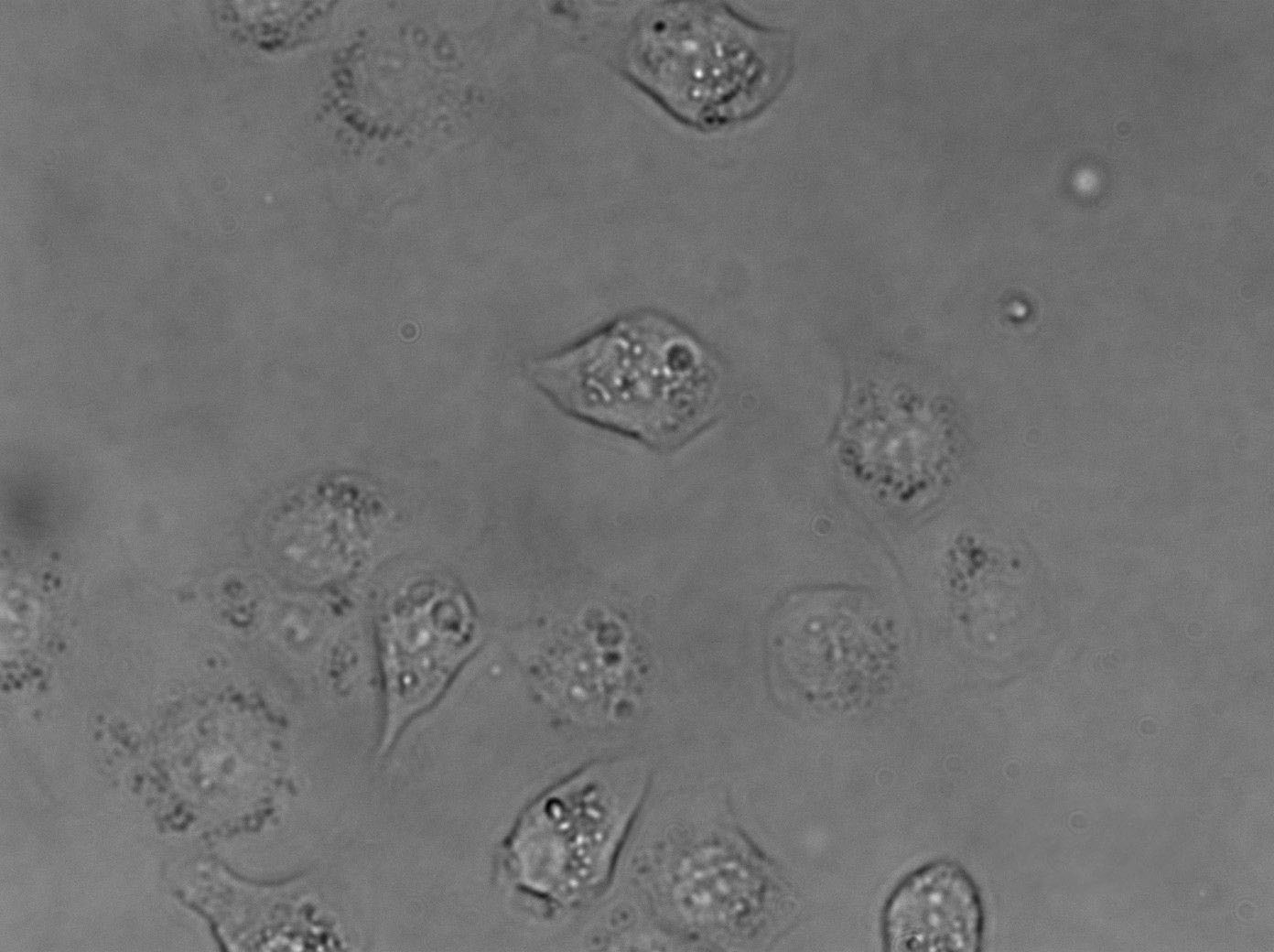 WSU-HN13 Cell|人口腔鳞状细胞癌细胞