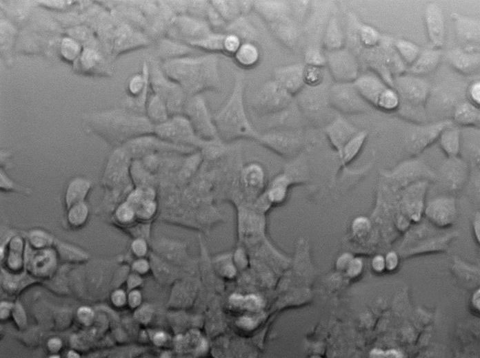 PaTu 8988s Cell|人胰腺癌细胞
