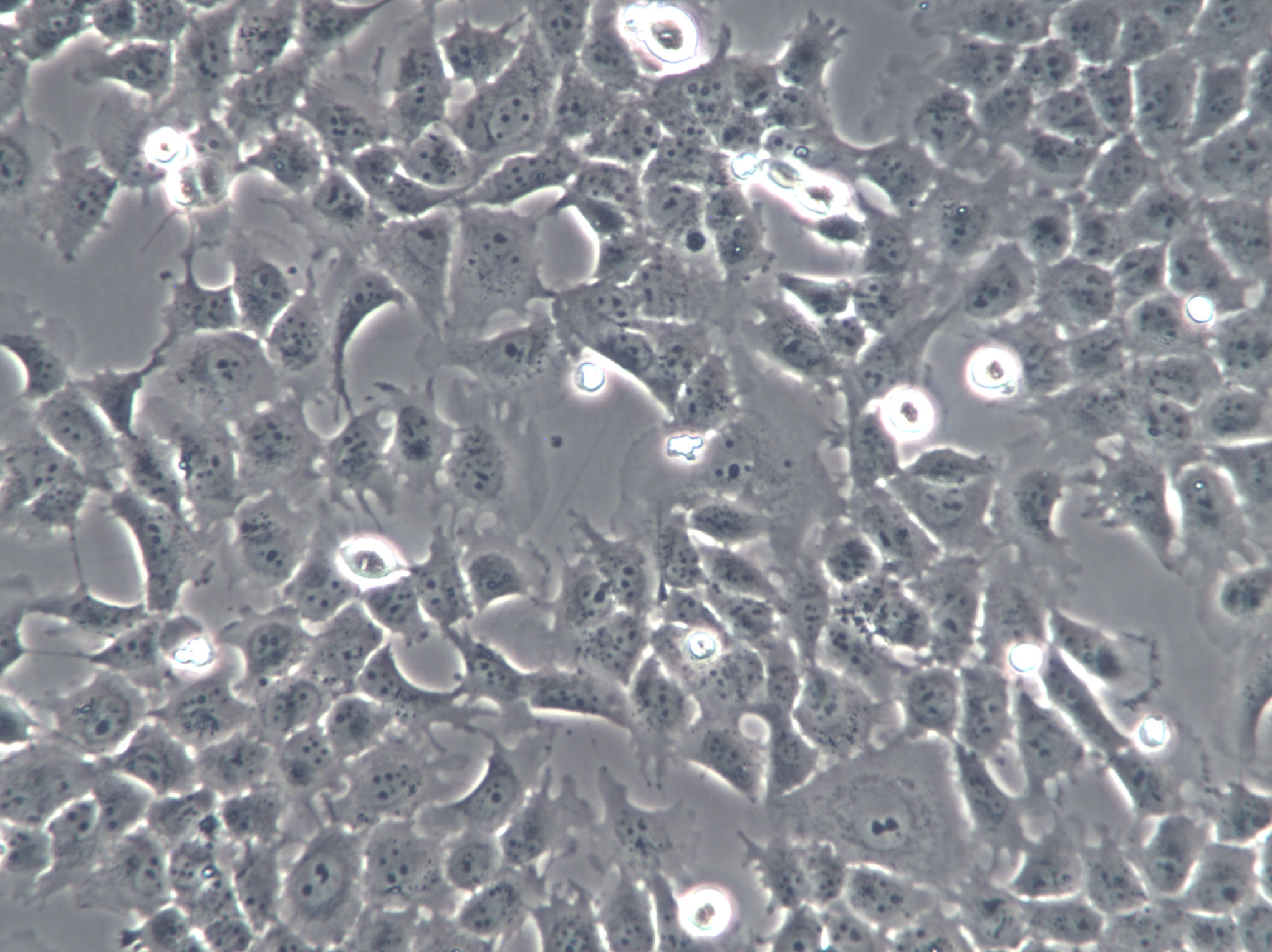 PIG1 Cell|正常人皮肤黑色素细胞