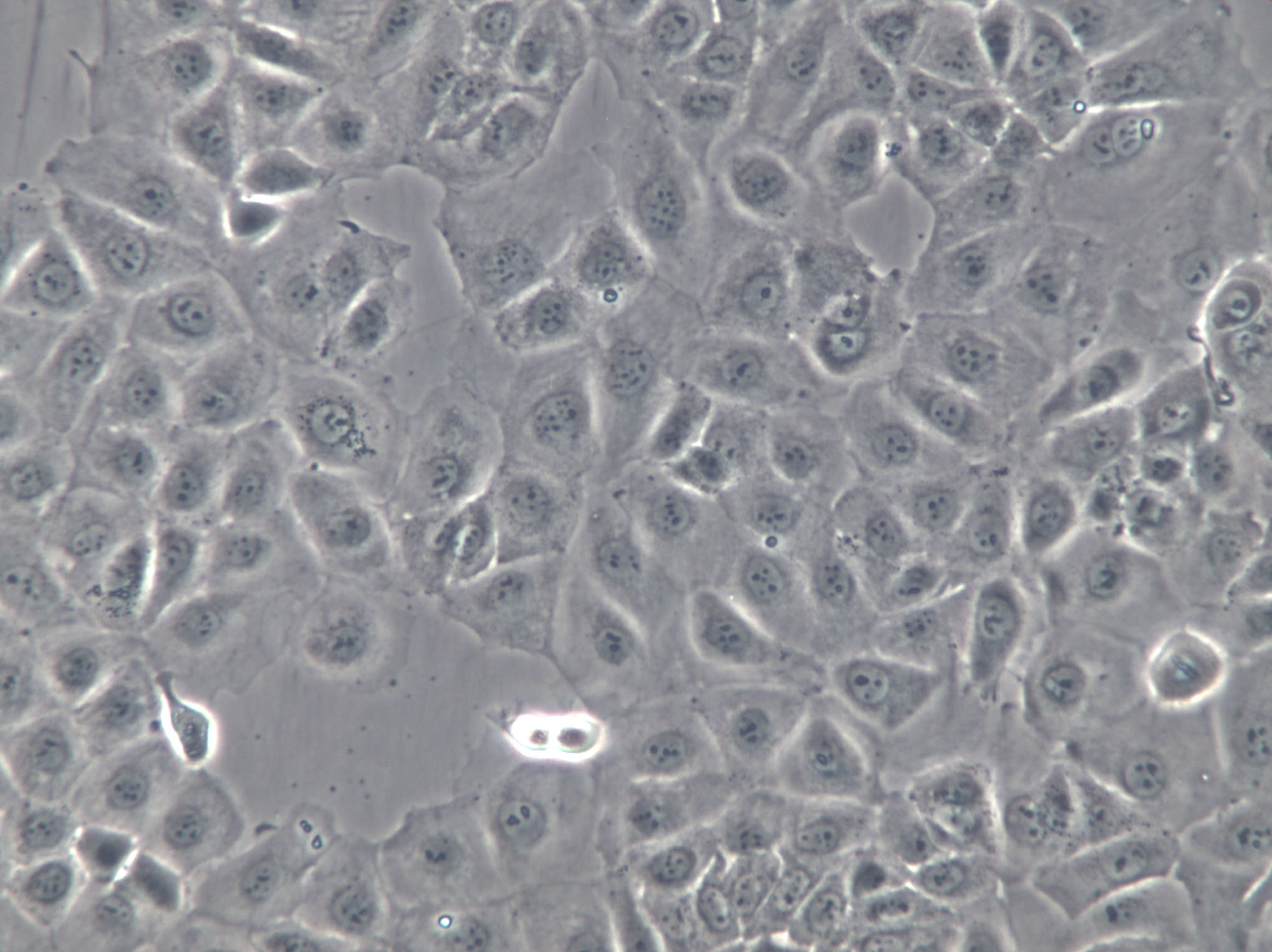 LNCaP C4-2B Cell|人前列腺癌细胞