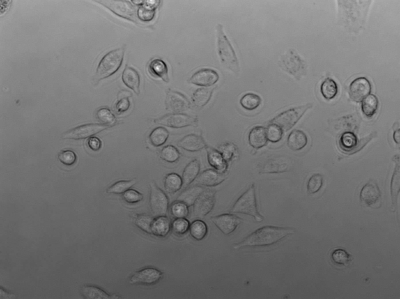 DOK Cell|人口腔黏膜癌前病变细胞