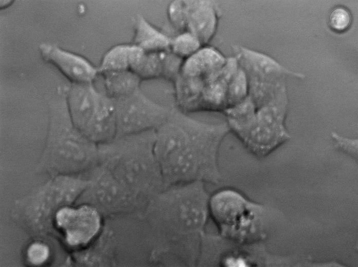 CAL-51 Cell|人乳腺癌细胞