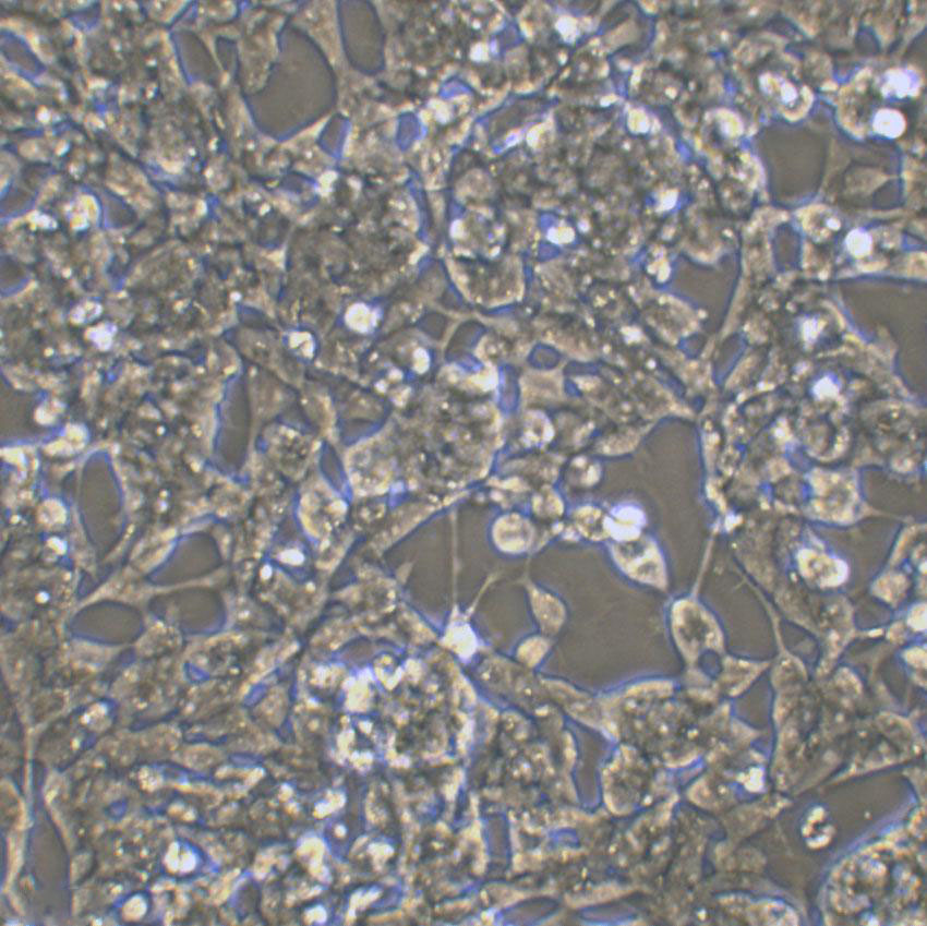 CAL-39 Cell|人外阴鳞癌细胞