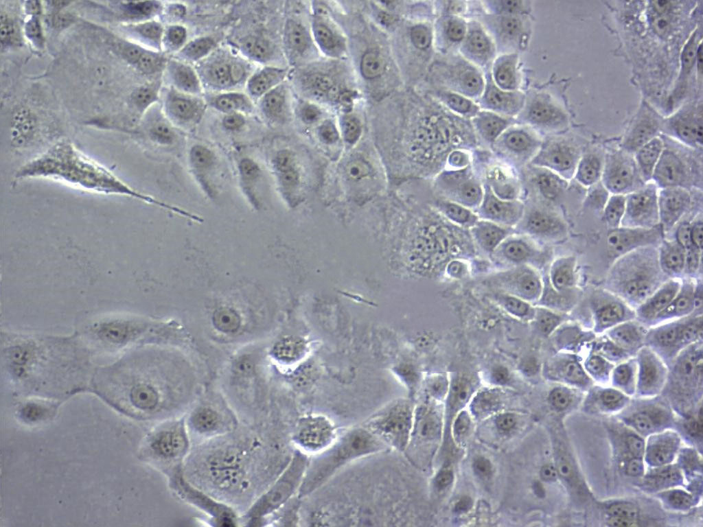 HIC Cell|人小肠癌细胞