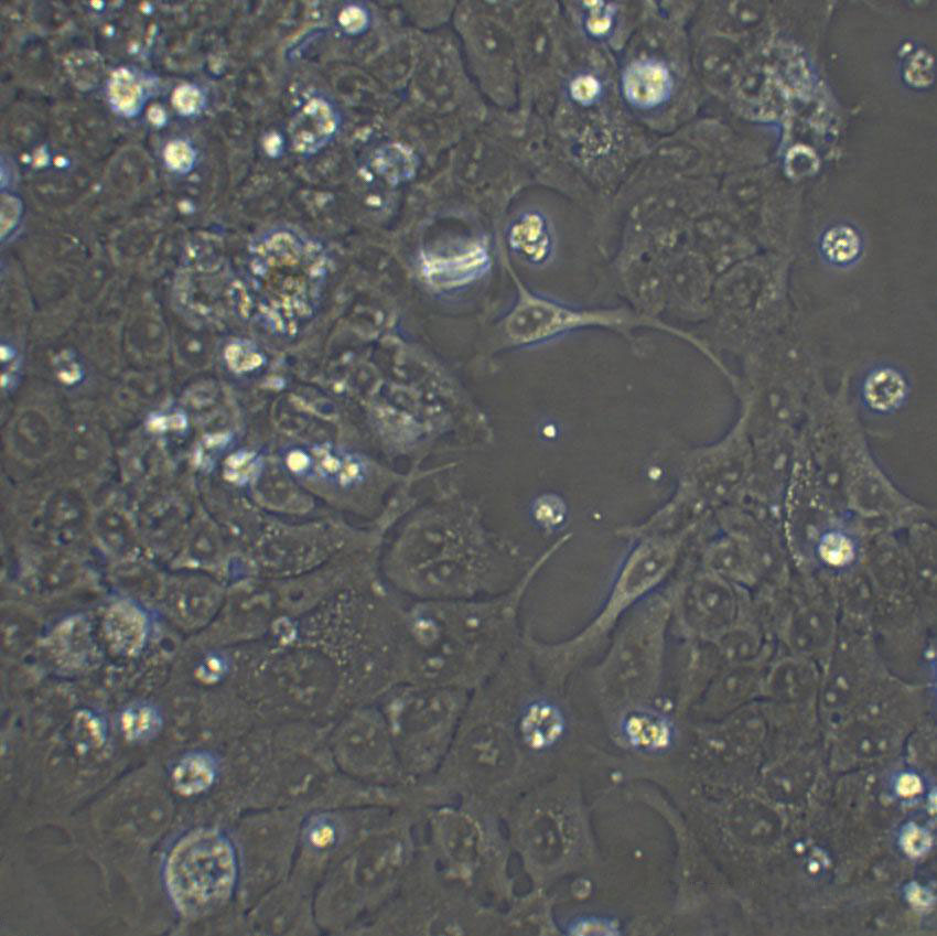 SCL-II Cell|人皮肤鳞癌细胞