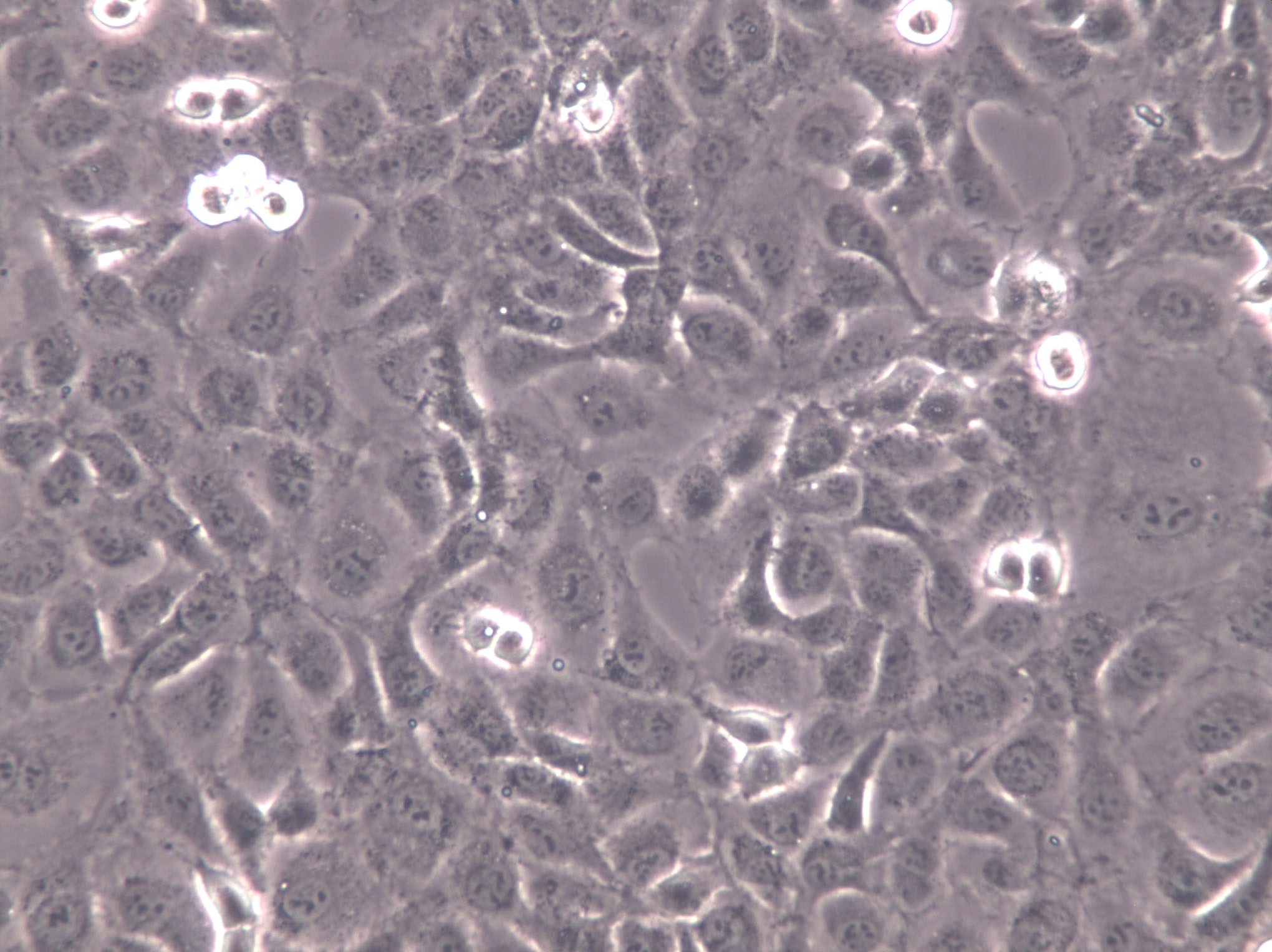KMM-1 Cell|人多发性骨髓瘤细胞