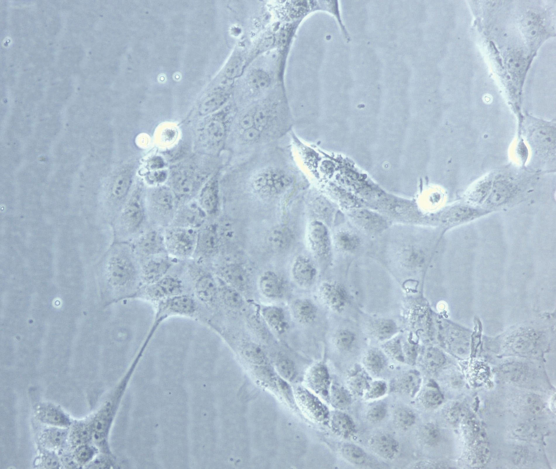 SACC-83 Cell|涎腺腺样囊性癌细胞