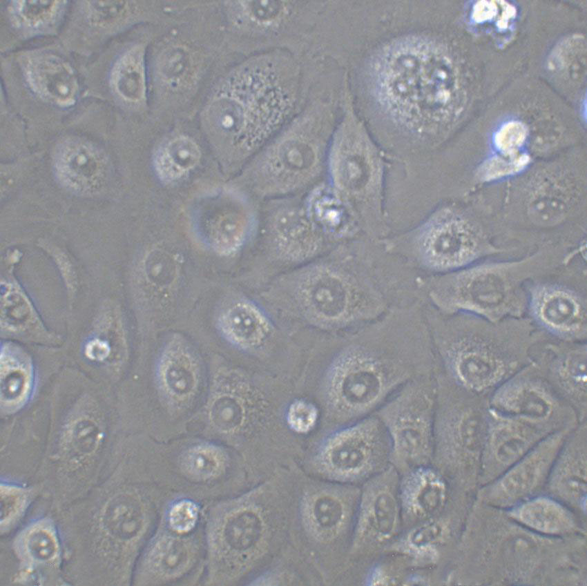 SACC-LM Cell|涎腺腺样囊性癌细胞