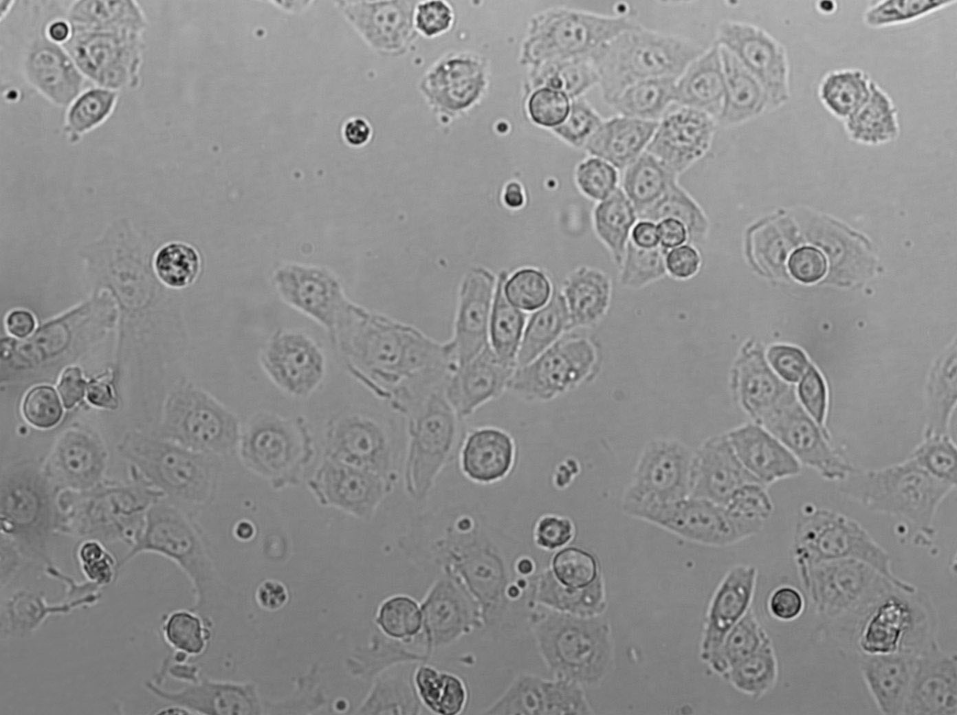 NP69SV40T Cell|人鼻咽上皮细胞