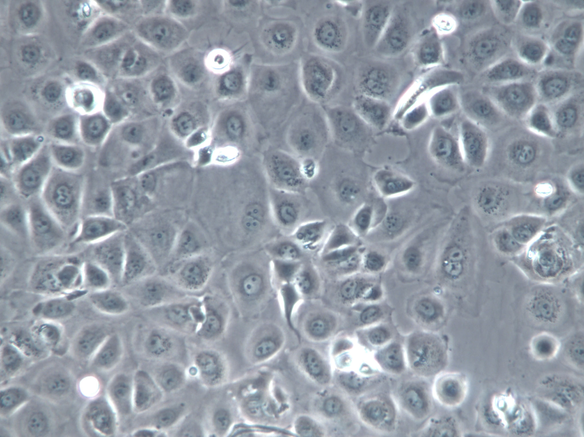 LA-N-1 Cell|人神经母细胞瘤细胞