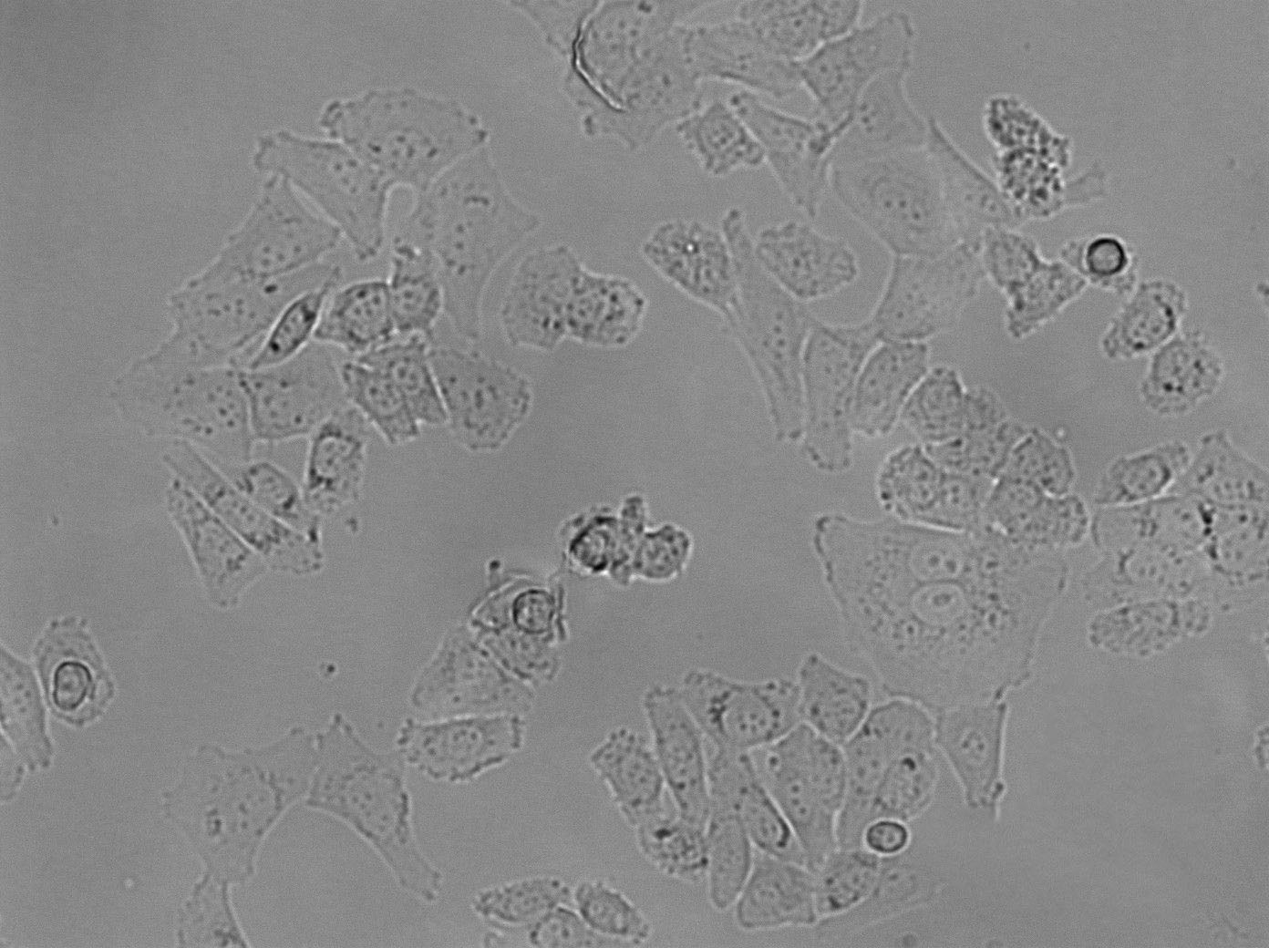 HCC2279 Cell|人肺腺鳞癌细胞
