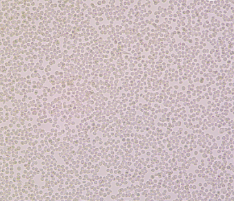 6T-CEM（人T细胞白血病细胞）