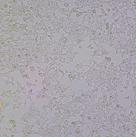 A20（小鼠B细胞淋巴瘤细胞）