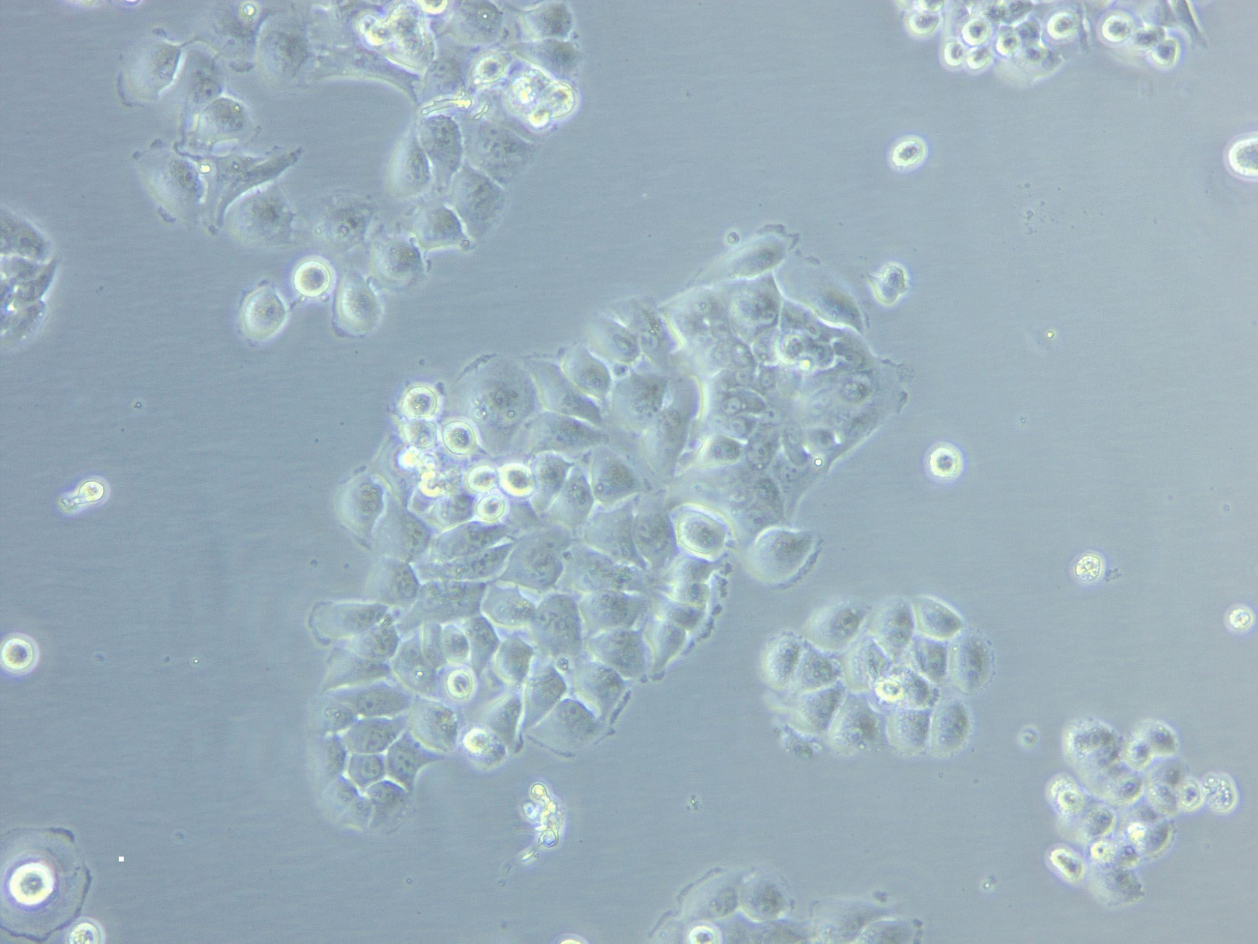 Mahlavu Cell|人肝癌细胞