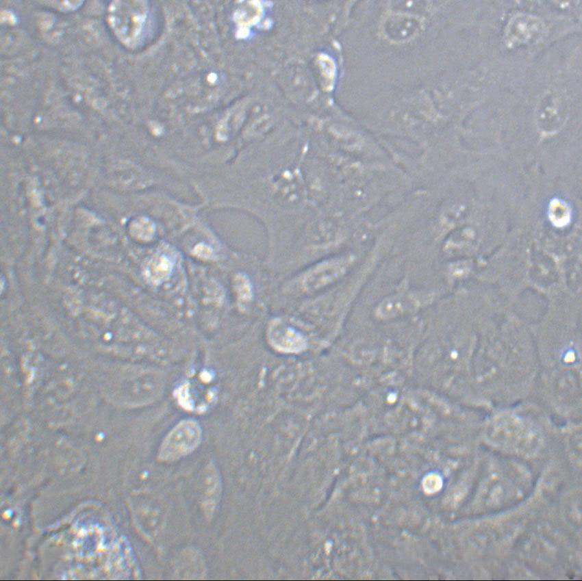 SUM149PT Cell|人乳腺癌细胞