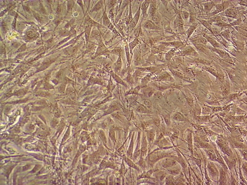 VMM5A Cell|人黑色素瘤细胞