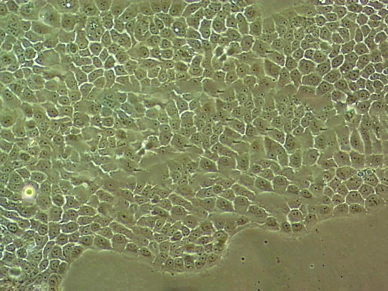 hEM15A Cell|人永生化子宫内膜异位症患者在位内膜间质细胞