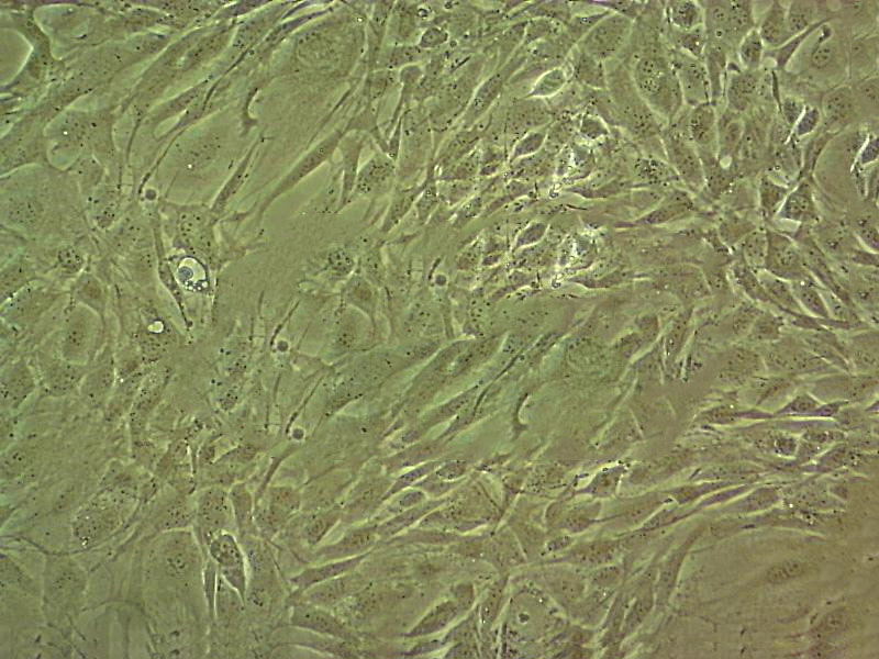 HCC2185 Cell|人乳腺转移性小叶癌细胞