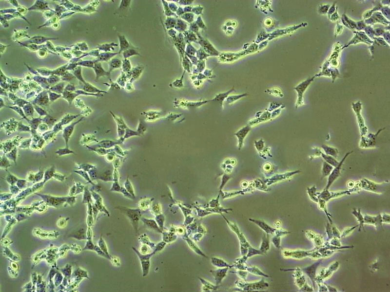 MuM-2C Cell|人眼脉络黑色素瘤细胞