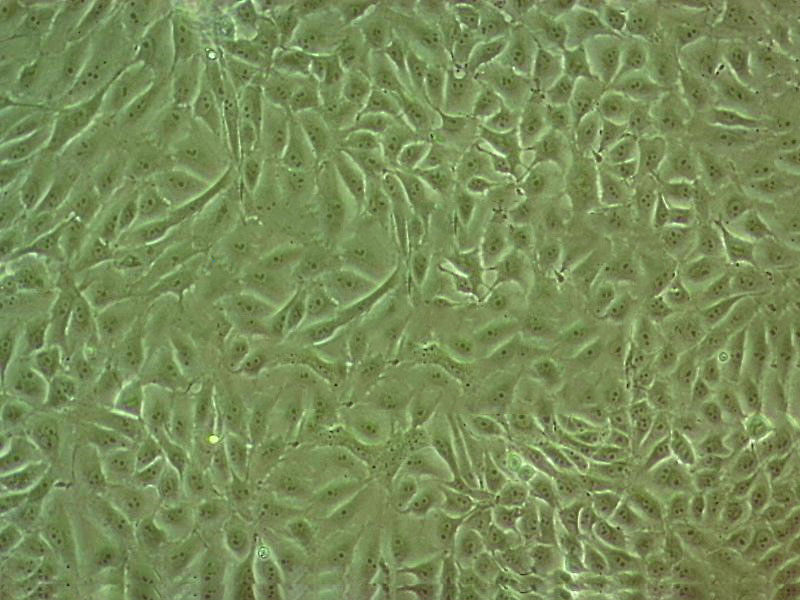Hca-F Cell|小鼠肝癌细胞
