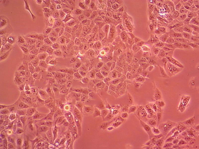 HCC1588 Cell|人肺鳞癌细胞