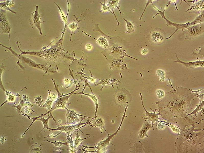 NCI-H128 Cell|人小细胞肺癌细胞