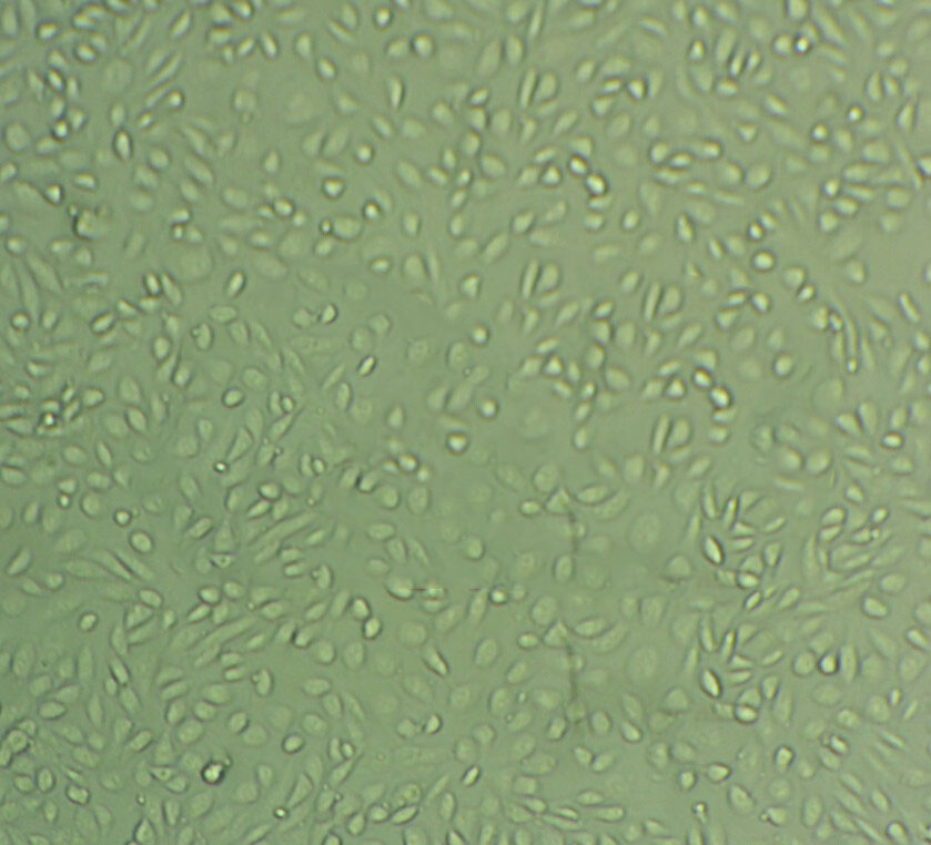 UMC-11 Cell|人肺良性肿瘤细胞