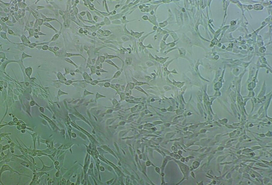 67NR Cell|小鼠乳腺癌细胞