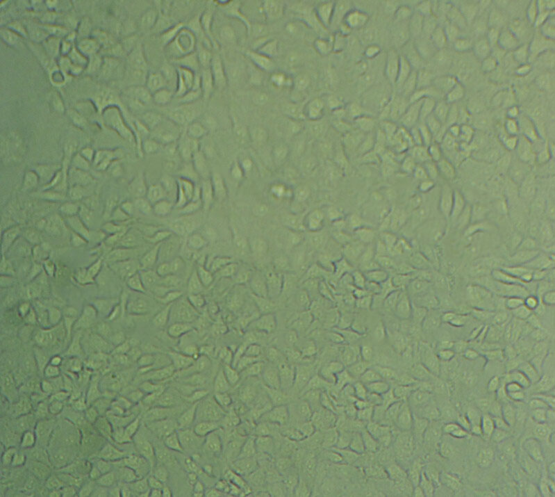 SK-RC-52 Cell|人肾癌细胞