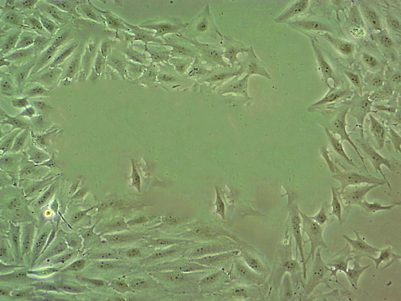 293AD Cell|人胚肾细胞