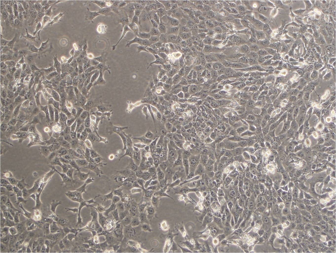 OCM-1 Cell|人眼脉络膜黑色素瘤细胞