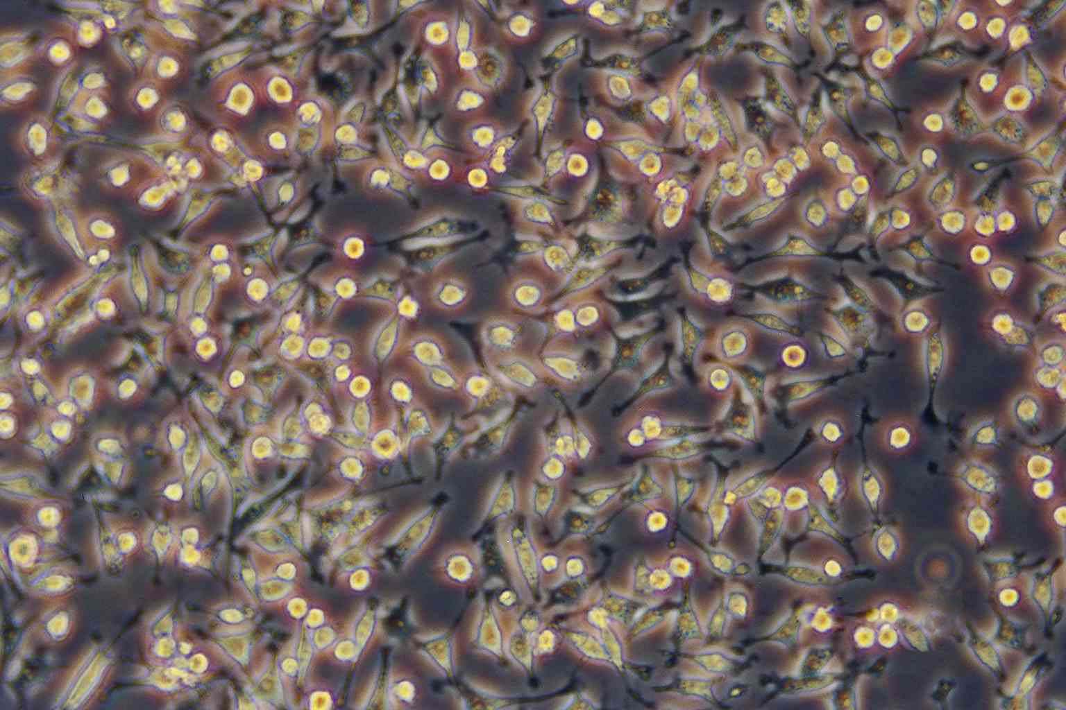 Clone M-3 Cell|小鼠黑色素瘤细胞