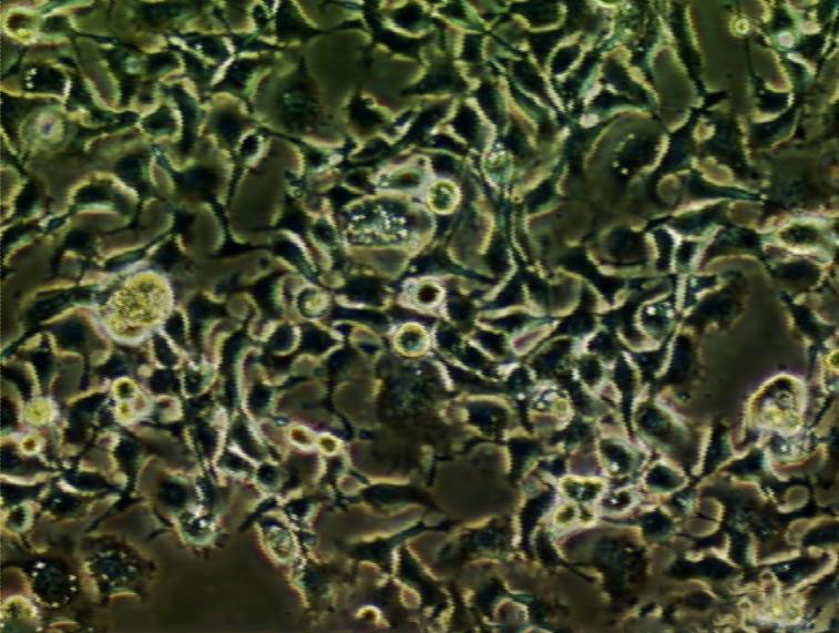 MM96L Cell|人黑色素瘤细胞