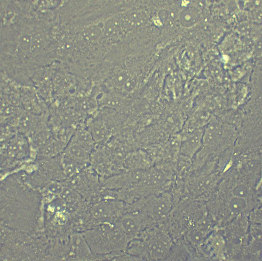 CMT64 Cell|小鼠肺腺癌细胞