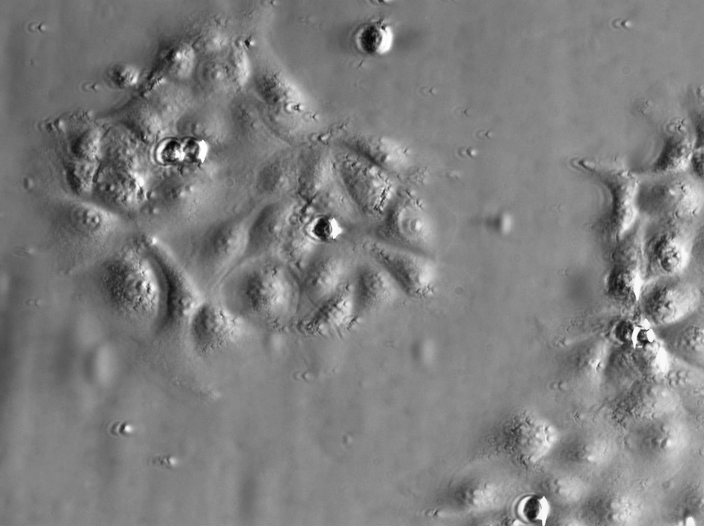 CL1-0 Cell|人肺腺癌细胞