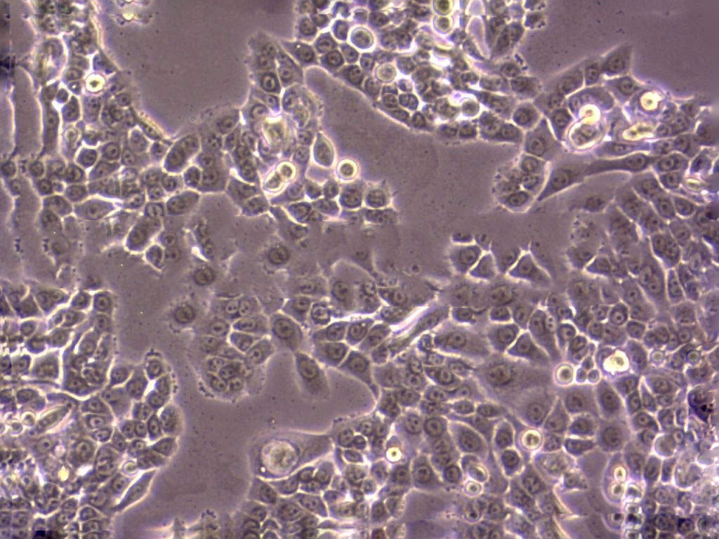 OSC-19 Cell|人舌鳞癌细胞