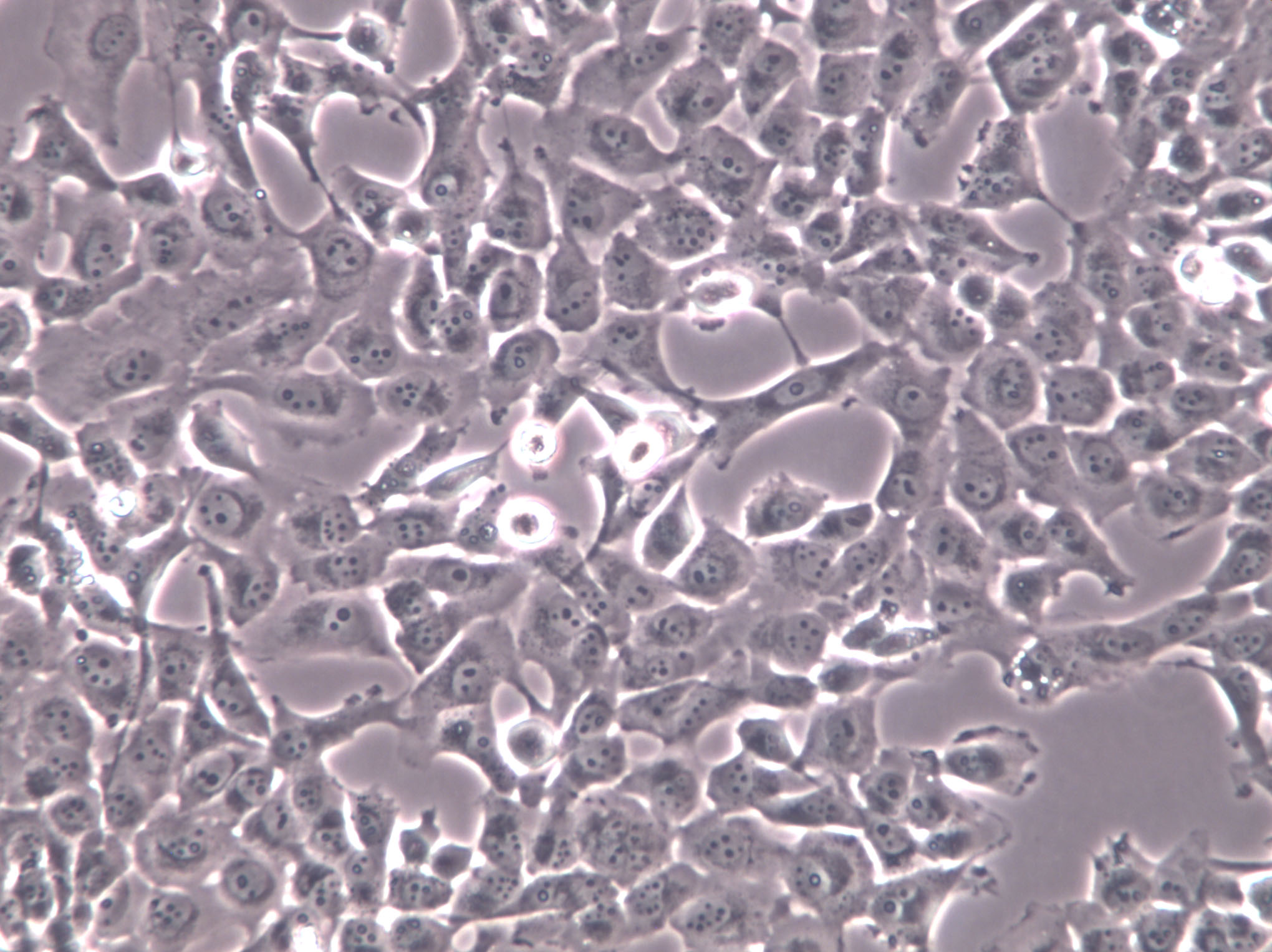 LOU-NH91 Cell|人肺鳞癌细胞