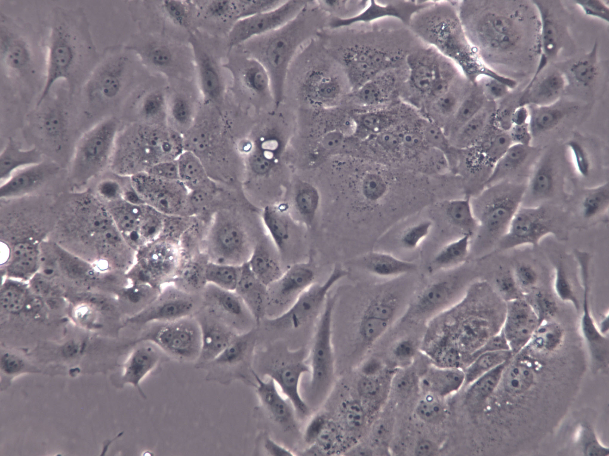 Co-115 Cell|人结肠腺癌细胞