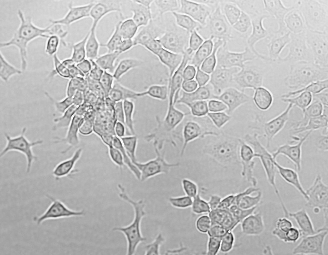 ACC-2 Cell|人涎腺腺样囊性癌细胞
