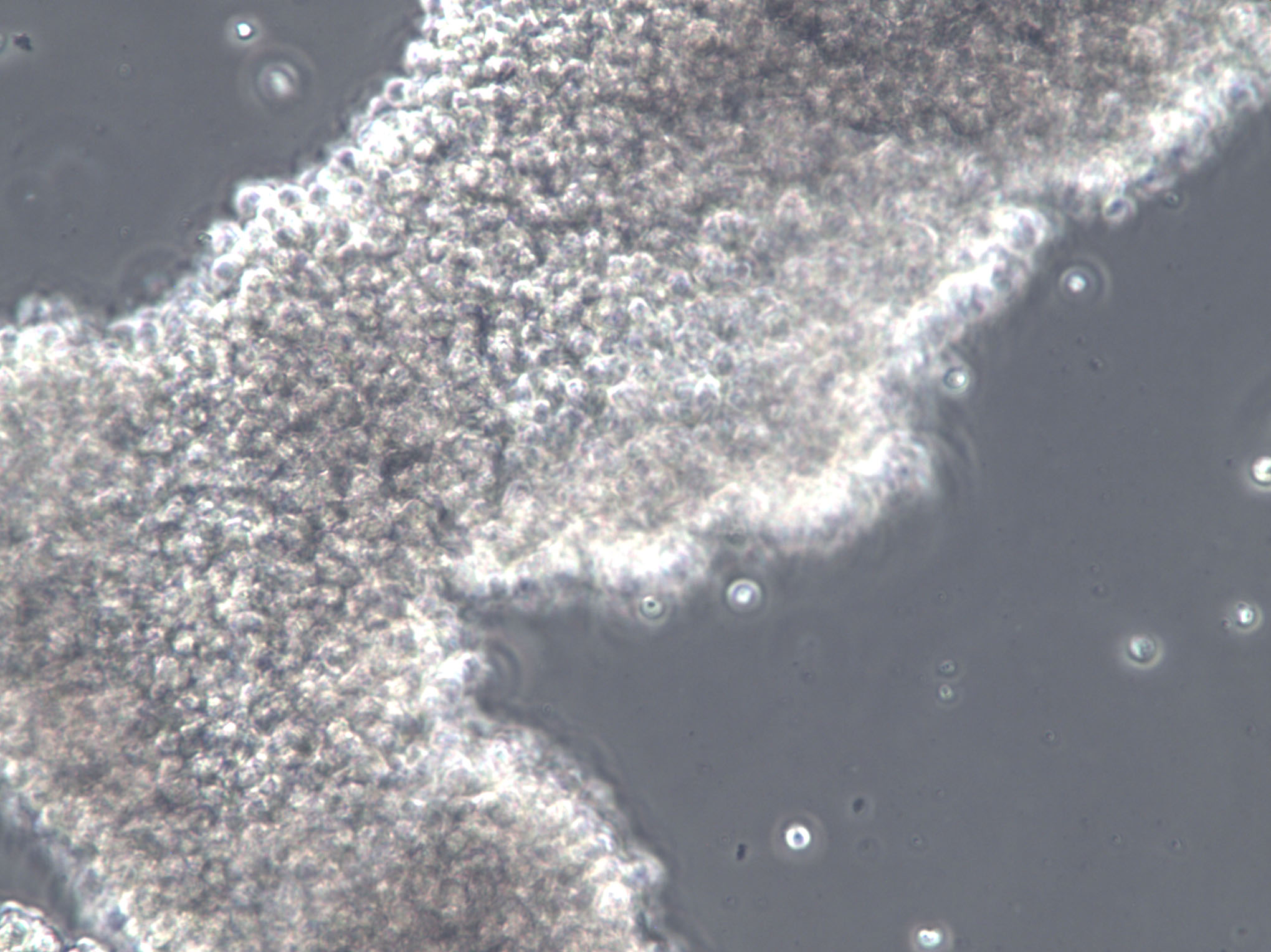 蜡状芽孢杆菌琼脂培养基基础